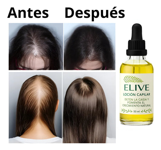 Oferta 3 x 2 Locion Capilar Elive 50ml Pack 3 meses