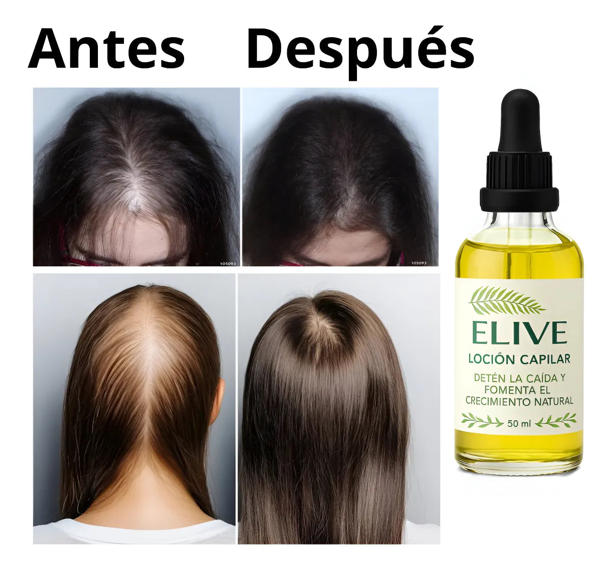 Oferta 3 x 2 Locion Capilar Elive 50ml Pack 3 meses