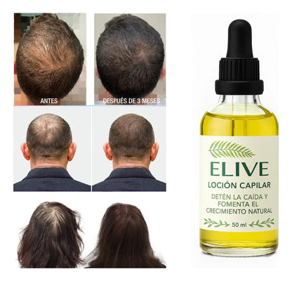 Oferta 3 x 2 Locion Capilar Elive 50ml Pack 3 meses